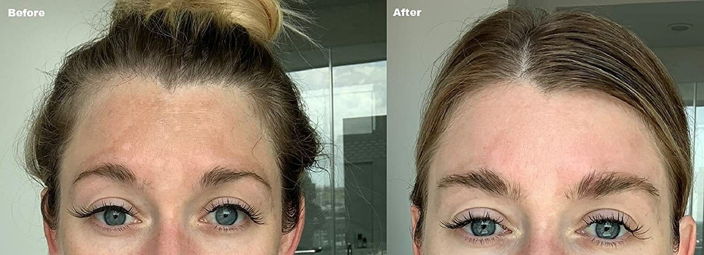 ADMIRE MY SKIN BRIGHTENING SERUM Whitening Lightening Dark Spot Bleaching Cream