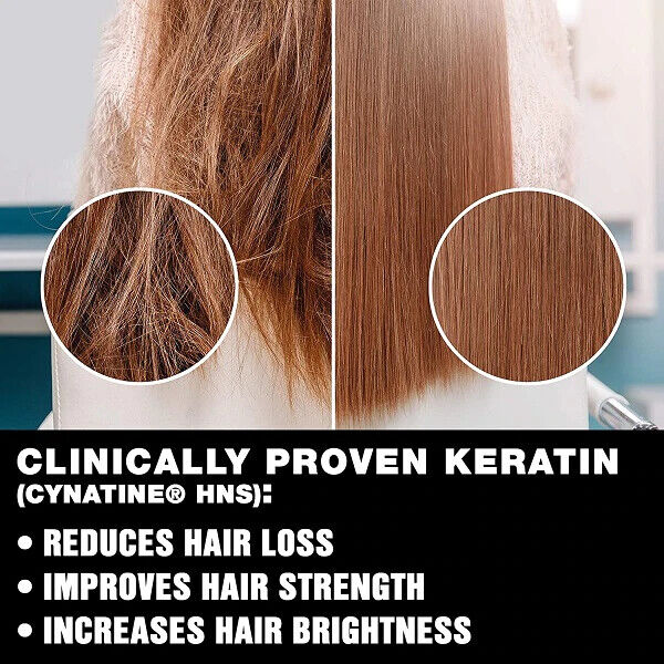 BIOTIN 10000 mcg + KERATIN 500mg HAIR GROWTH VITAMINS REDUCE HAIR LOSS - 30 CAPS