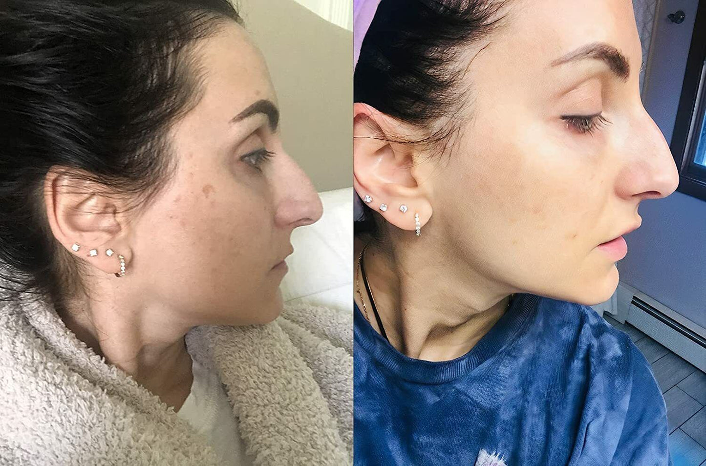 ADMIRE MY SKIN BRIGHTENING SERUM Whitening Lightening Dark Spot Bleaching Cream
