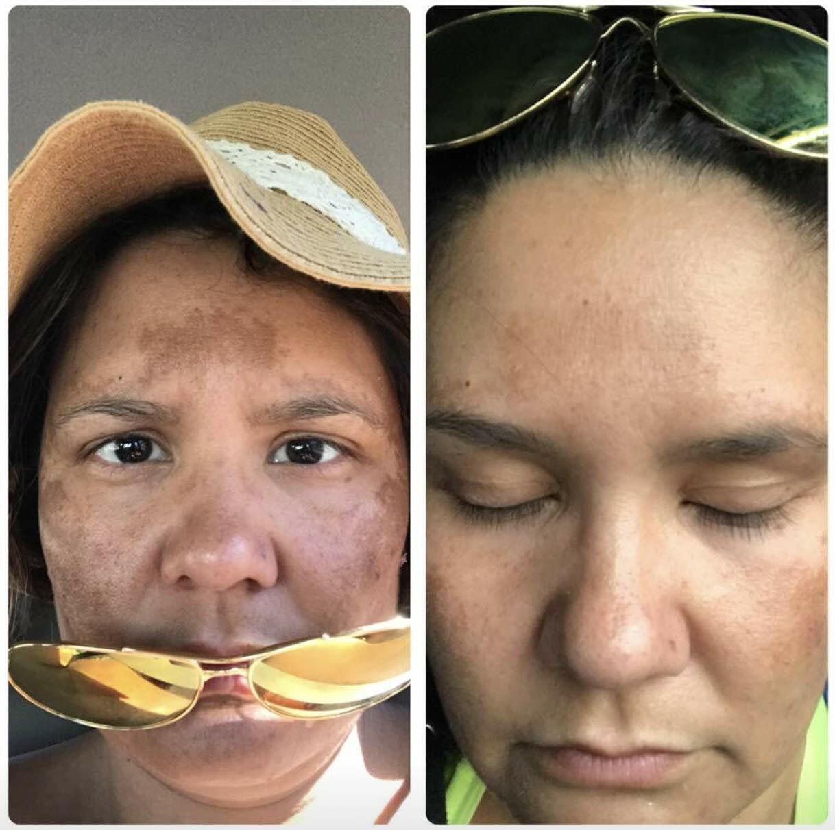 ADMIRE MY SKIN BRIGHTENING SERUM Whitening Lightening Dark Spot Bleaching Cream