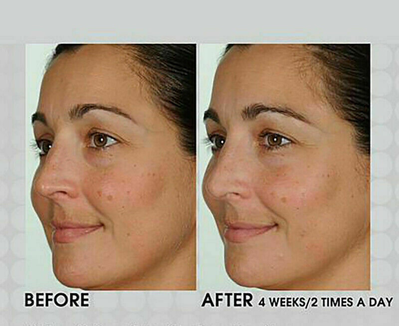 PURE RETINOL VITAMIN A 2.5% + HYALURONIC ACID HA SERUM 35mL - FREE EXPRESS POST