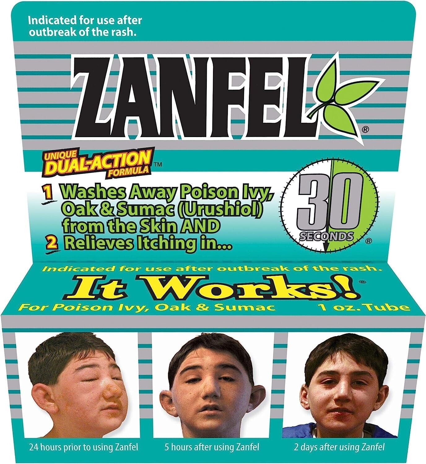ZANFEL Poison Ivy Oak Sumac Urushiol Skin Wash - Itch Pain Rash Relief - 30mL