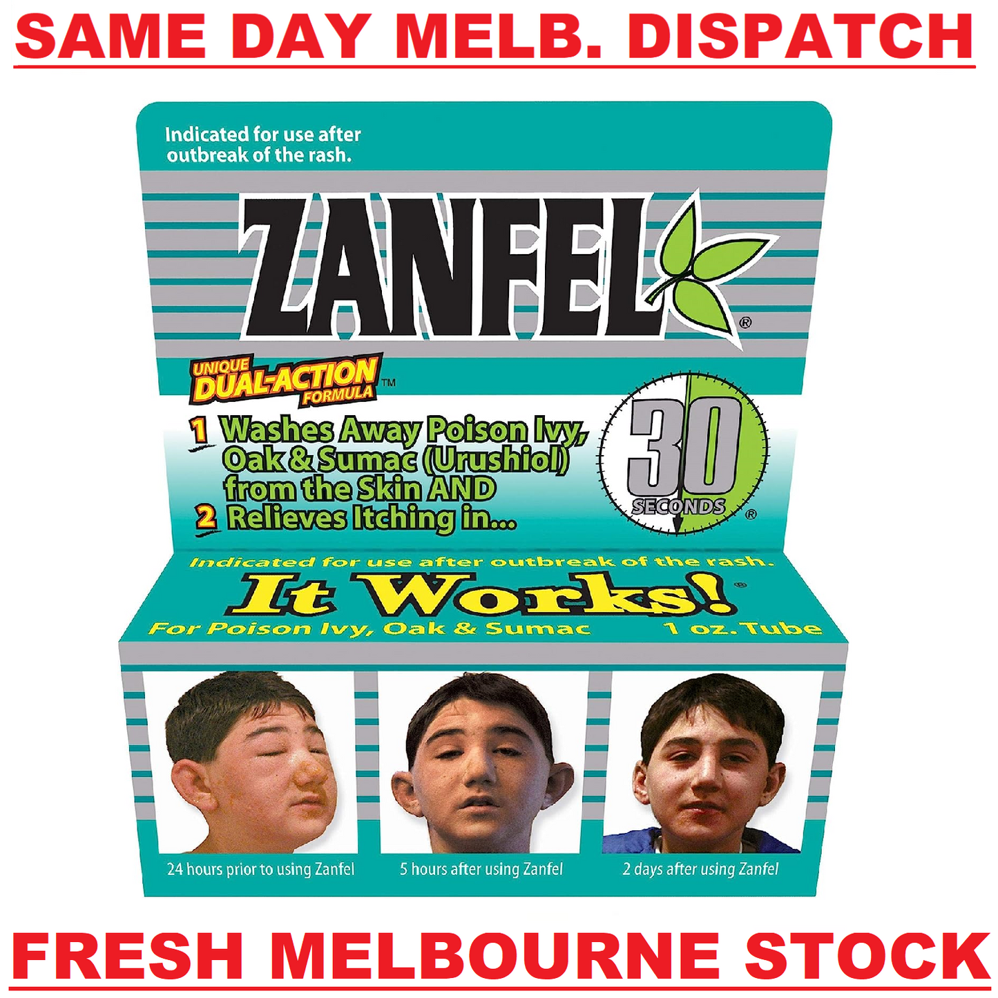 ZANFEL Poison Ivy Oak Sumac Urushiol Skin Wash - Itch Pain Rash Relief - 30mL