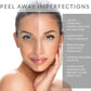 LACTIC ACID FACIAL SKIN PEEL Acne Wrinkles Melasma Age Sun Spots 25% 40% 50% 90%