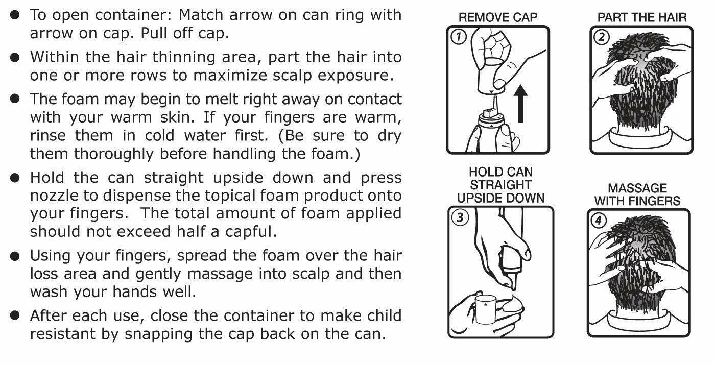 Kirkland Minoxidil 5% Topical Hair Loss Regrowth FOAM Treatment Regaine - FREE EXPRESS