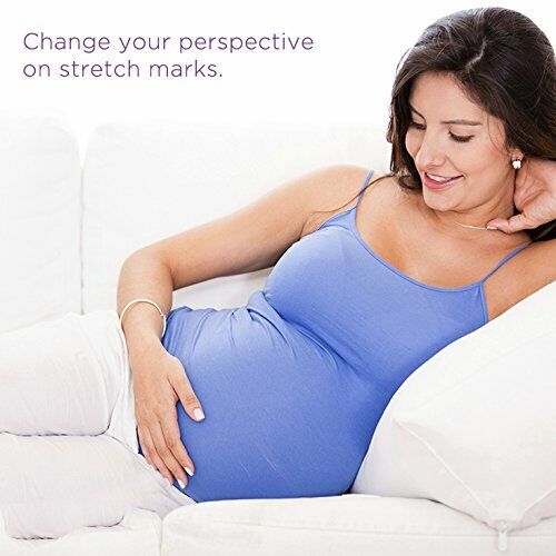 MEDERMA STRETCH MARKS THERAPY CREAM 150G / 5.29OZ BRAND NEW & SEALED