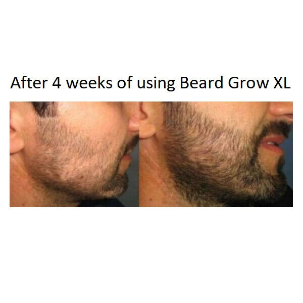 BEARD GROW XL Mens Facial Hair Growth Supplement DHT BLOCKER - FREE EXPRESS POST