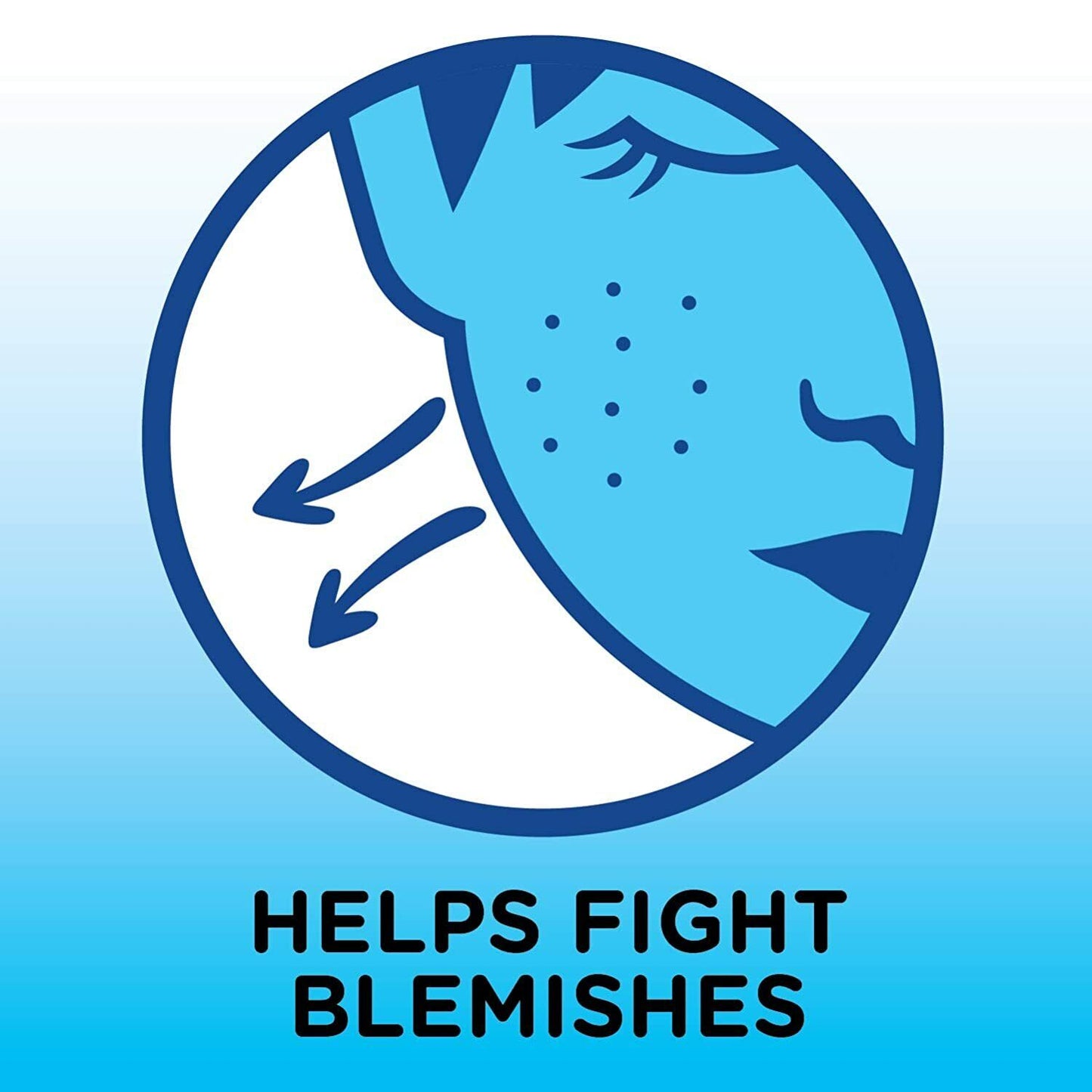 Solimo 10% Benzoyl Peroxide Acne Cream Medication MAXIMUM STRENGTH Skin Care 28g