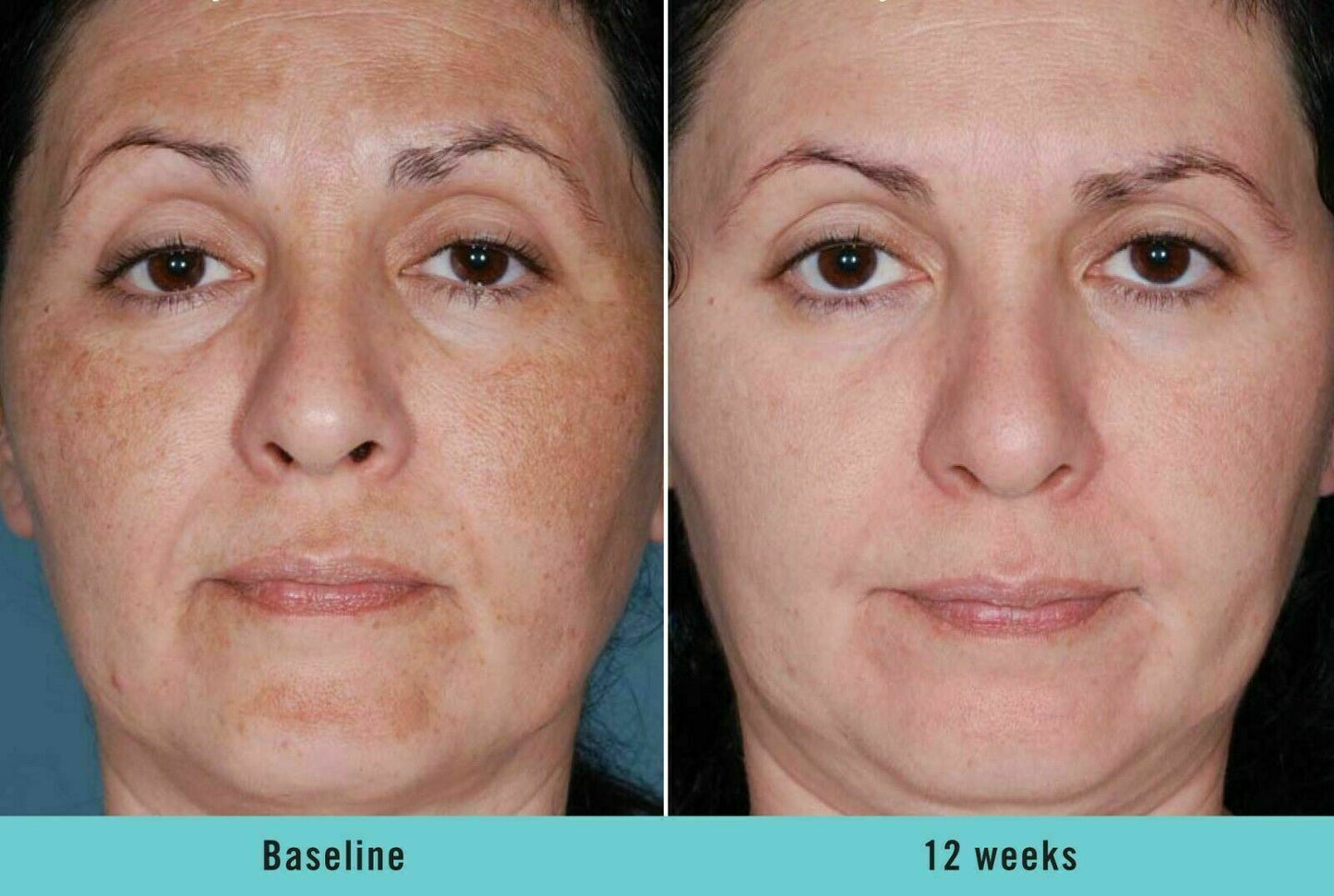 DARK SKIN WHITENING LIGHTENING ULTRA BRIGHTENING SERUM 30mL - FREE EXPRESS POST