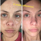 ADMIRE MY SKIN BRIGHTENING SERUM Whitening Lightening Dark Spot Bleaching Cream