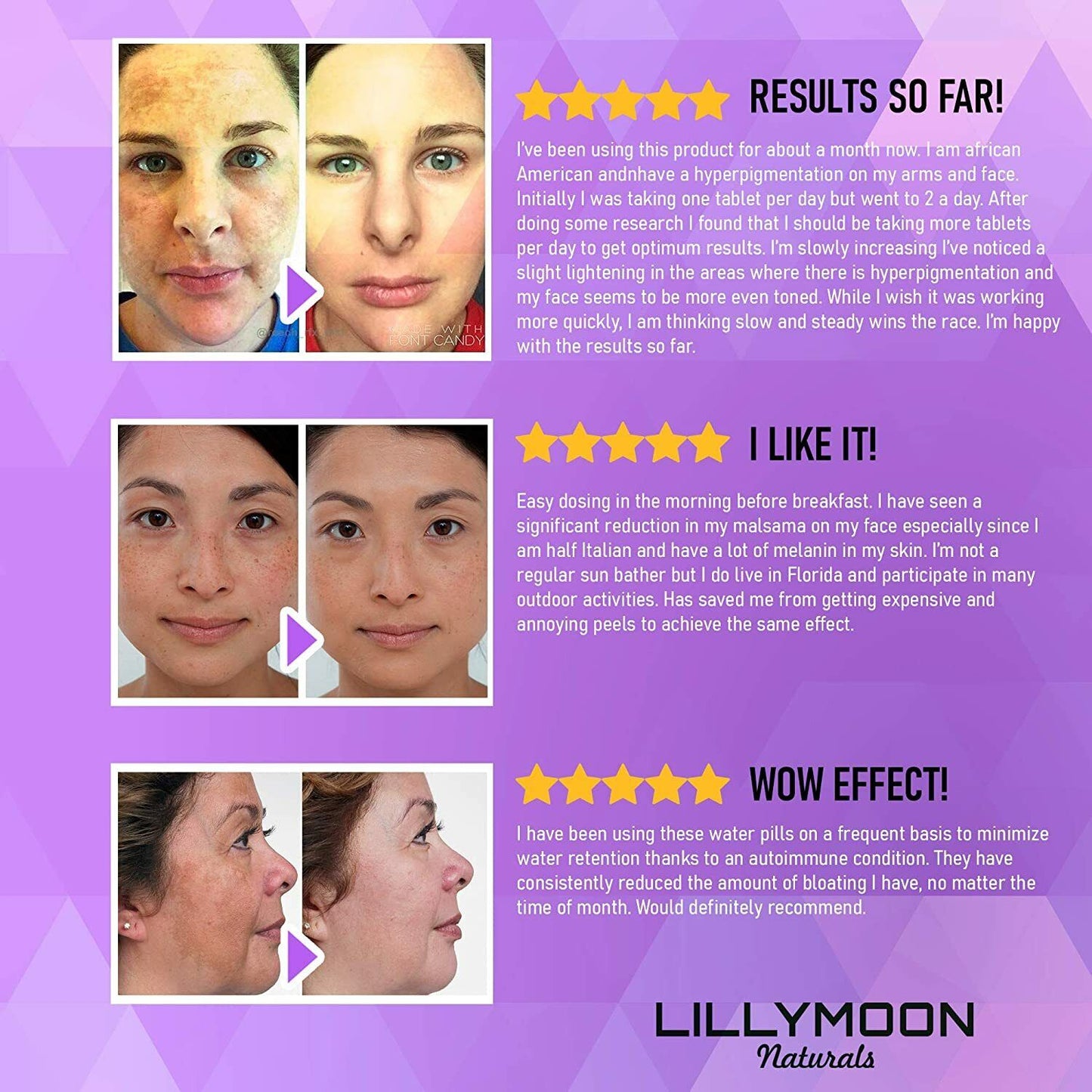 LILLYMOON SKIN WHITENING PILLS 4000mg Glutathione Brightening Lightening 60 Caps