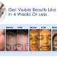 ADMIRE MY SKIN BRIGHTENING SERUM Whitening Lightening Dark Spot Bleaching Cream