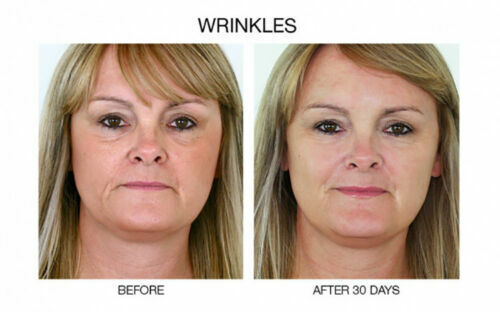 STEM CELL SERUM Anti Aging Real Stem Cell Cultures Matrixyl 3000 Hyaluronic Acid