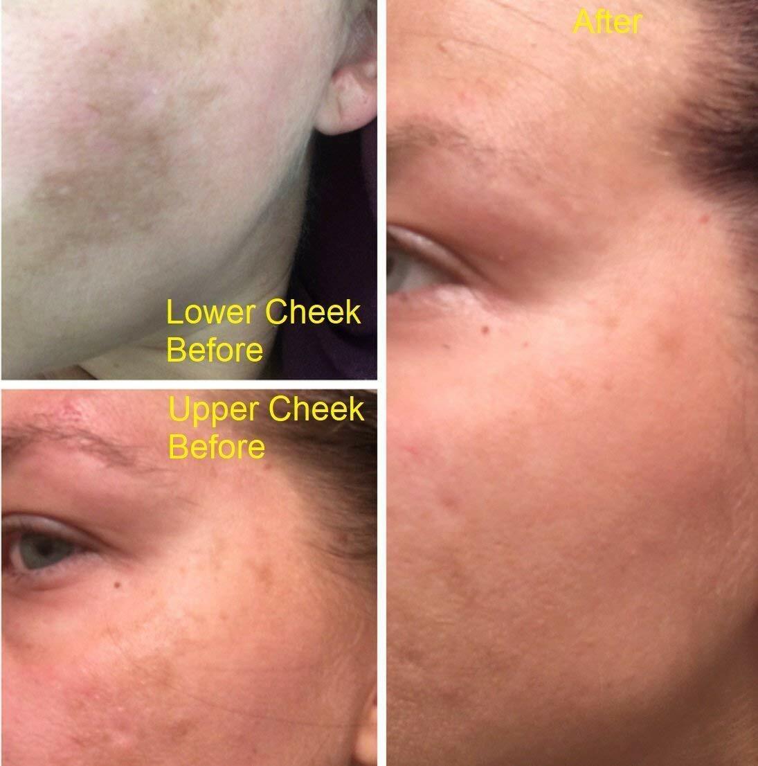 ADMIRE MY SKIN BRIGHTENING SERUM Whitening Lightening Dark Spot Bleaching Cream