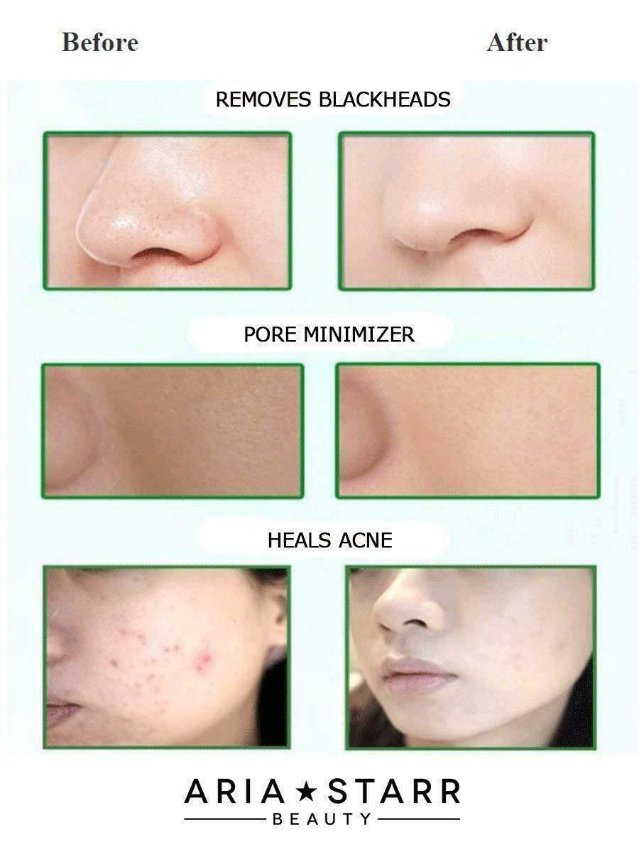 ARIA STARR DEAD SEA MUD MASK Acne Detox Blackheads Pores 250g FREE EXPRESS POST!