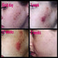 ADMIRE MY SKIN BRIGHTENING SERUM Whitening Lightening Dark Spot Bleaching Cream