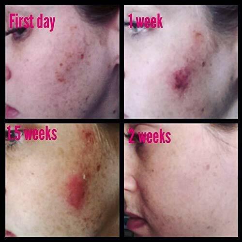 ADMIRE MY SKIN BRIGHTENING SERUM Whitening Lightening Dark Spot Bleaching Cream