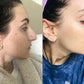 ADMIRE MY SKIN BRIGHTENING SERUM Whitening Lightening Dark Spot Bleaching Cream
