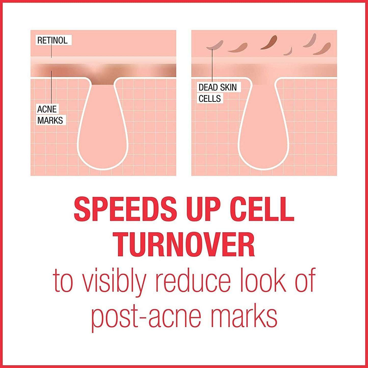 Neutrogena Stubborn Marks PM Treatment NIGHT Skin Care Acne Tone Retinol SA 29ml