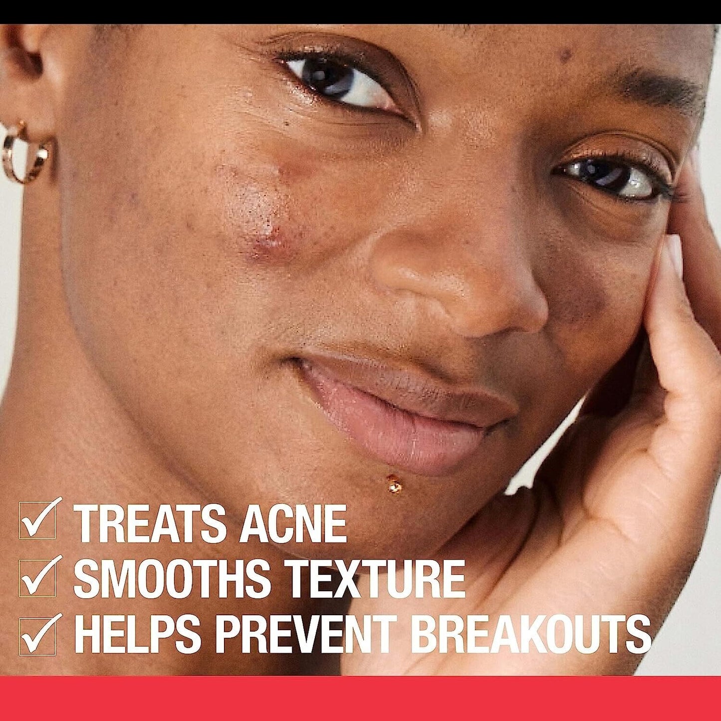 Neutrogena Stubborn Texture - Salicylic Acid Cleanser Daily Acne Treatment 186mL