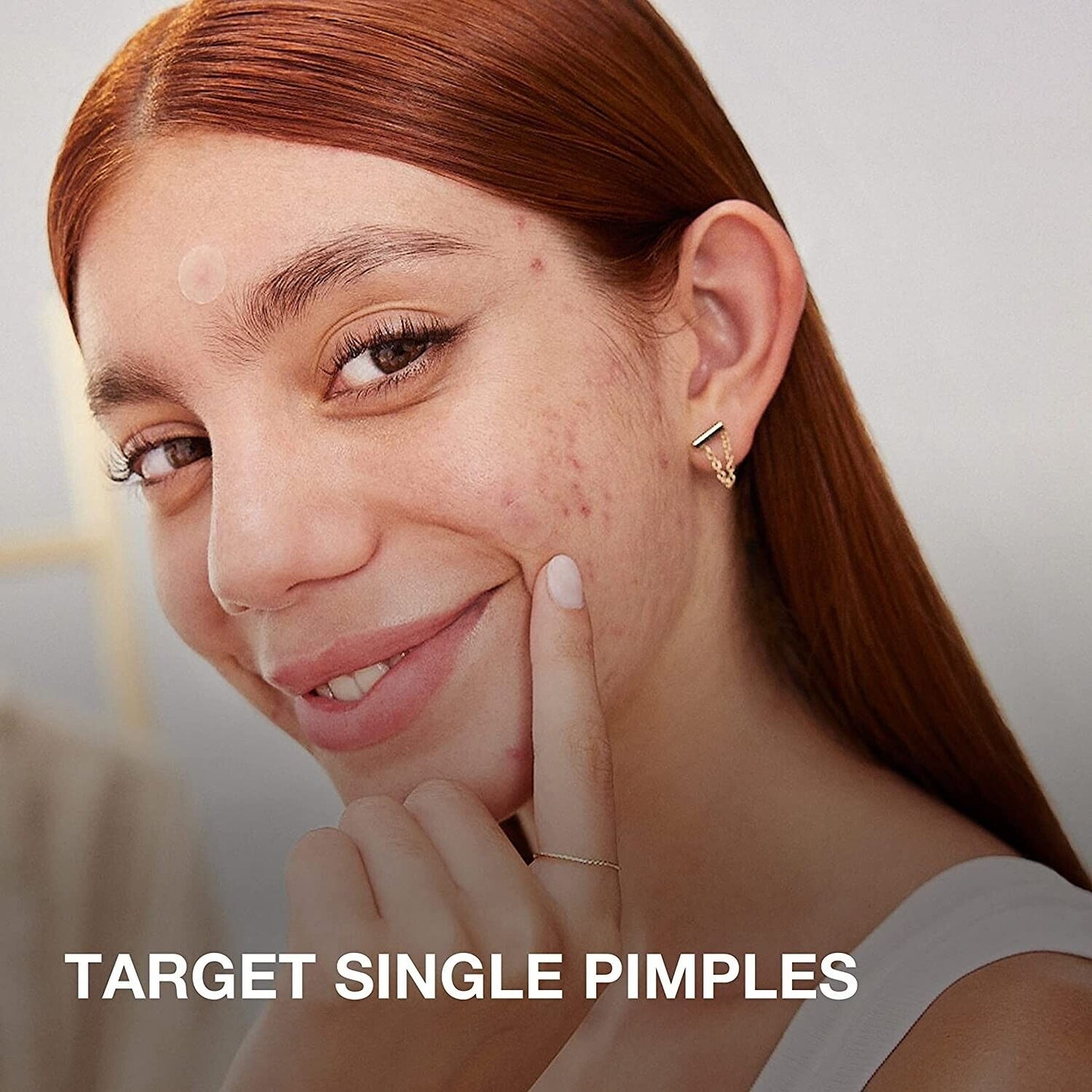 Neutrogena Stubborn Acne Ultra Thin Hydrocolloid Blemish Pimple Patches 24 Pack