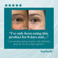 BAEBODY EYE GEL Face Wrinkles Dark Circles Puffiness Hyaluronic Acid Anti Aging