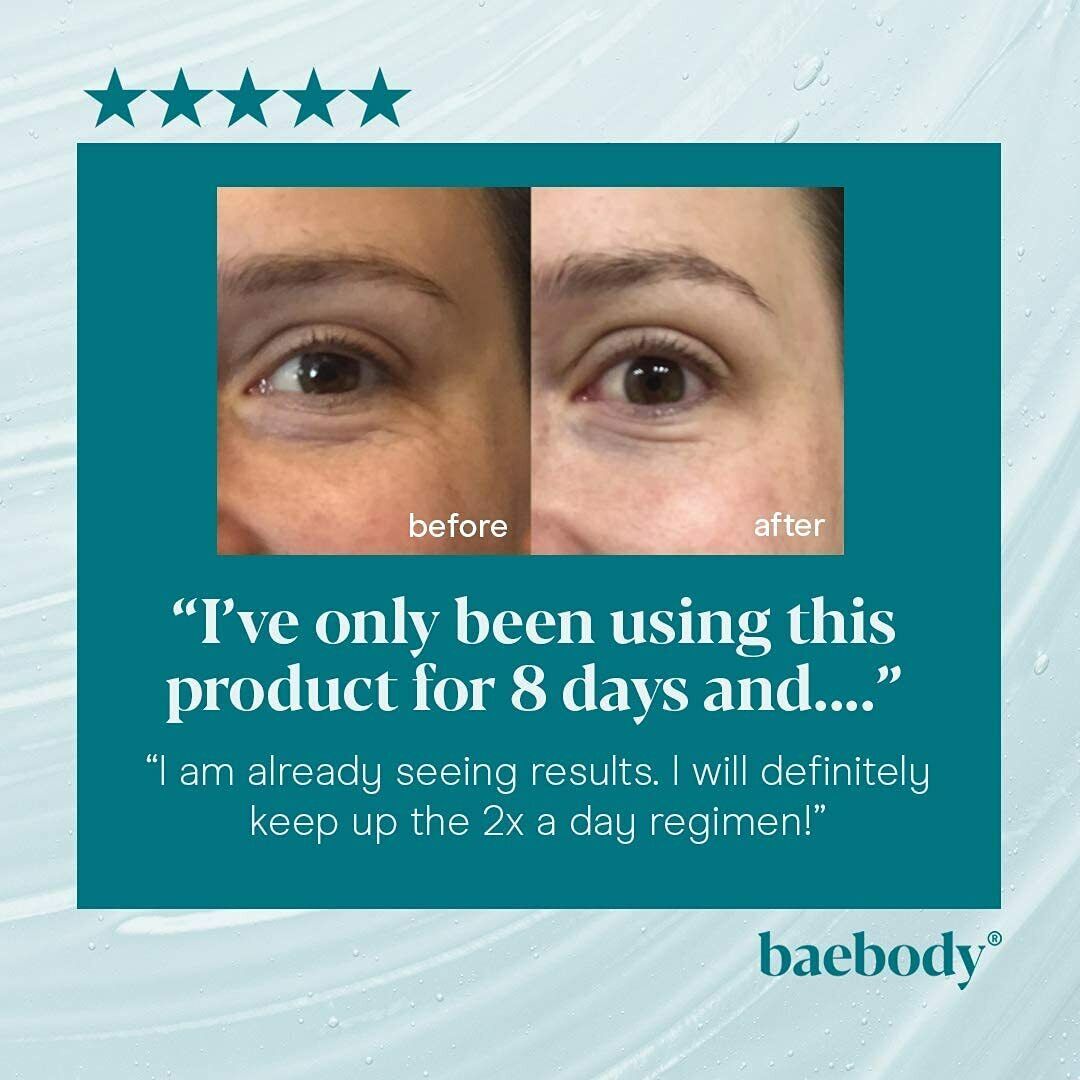 BAEBODY EYE GEL Face Wrinkles Dark Circles Puffiness Hyaluronic Acid Anti Aging