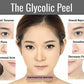 GLYCOLIC ACID CHEMICAL FACE PEEL Kit Medical Grade 100% Pure Acne Scars Wrinkles