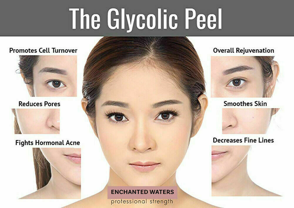 GLYCOLIC ACID CHEMICAL FACE PEEL Kit Medical Grade 100% Pure Acne Scars Wrinkles