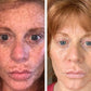 ADMIRE MY SKIN BRIGHTENING SERUM Whitening Lightening Dark Spot Bleaching Cream