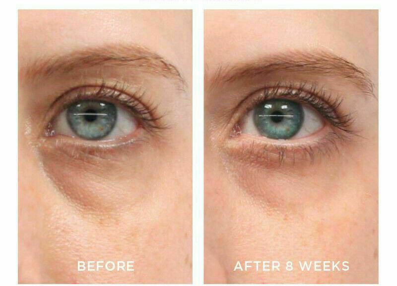 PURE RETINOL VITAMIN A 2.5% + HYALURONIC ACID HA SERUM 35mL - FREE EXPRESS POST