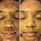 ADMIRE MY SKIN BRIGHTENING SERUM Whitening Lightening Dark Spot Bleaching Cream