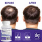 PROPIDREN Hair Growth Loss Vitamins DHT Blocker Biotin Saw Palmetto Supplement