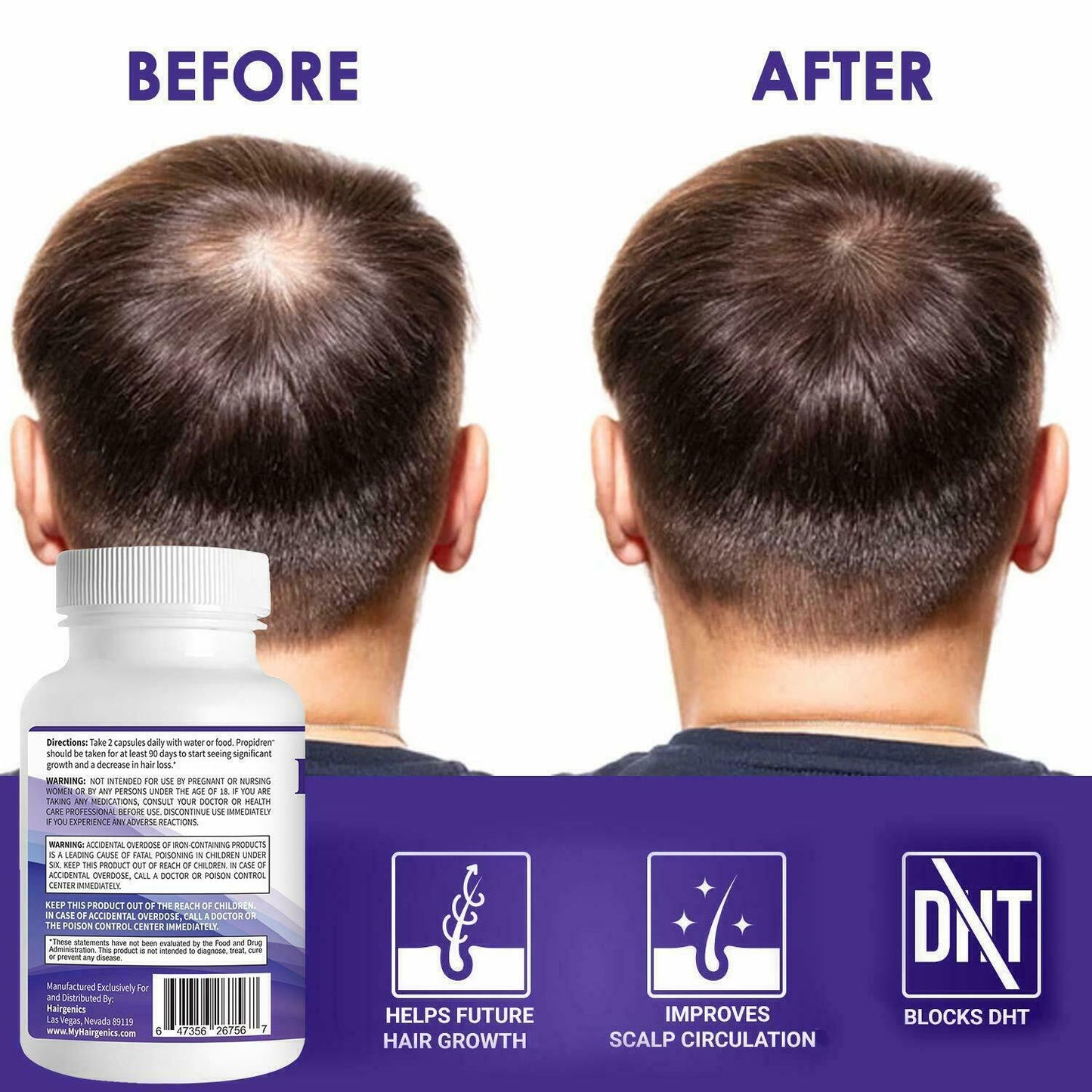 PROPIDREN Hair Growth Loss Vitamins DHT Blocker Biotin Saw Palmetto Supplement