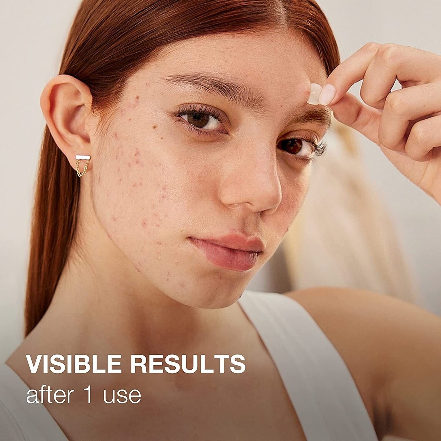 Neutrogena Stubborn Acne Ultra Thin Hydrocolloid Blemish Pimple Patches 24 Pack