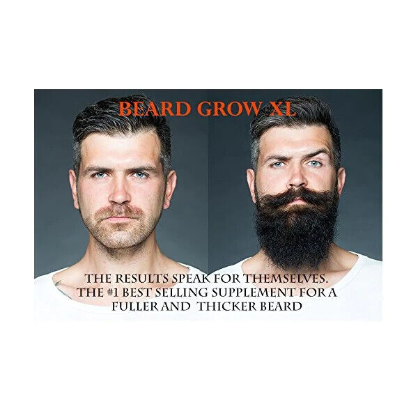BEARD GROW XL Mens Facial Hair Growth Supplement DHT BLOCKER - FREE EXPRESS POST