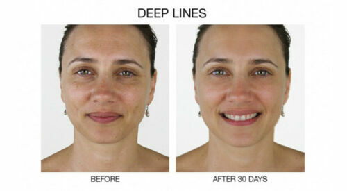 STEM CELL SERUM Anti Aging Real Stem Cell Cultures Matrixyl 3000 Hyaluronic Acid