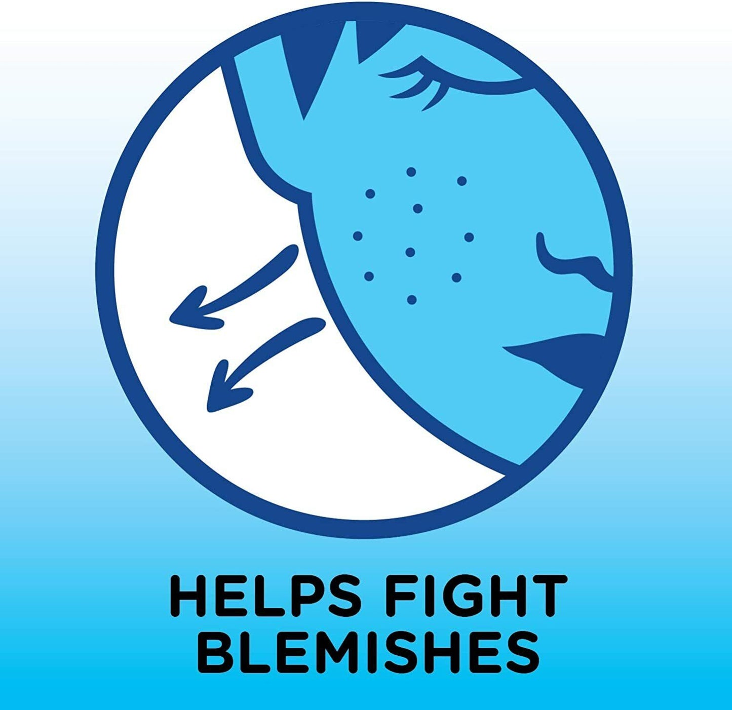 Solimo Daily Acne Control Cleanser Maximum Strength 10% Benzoyl Peroxide 141g